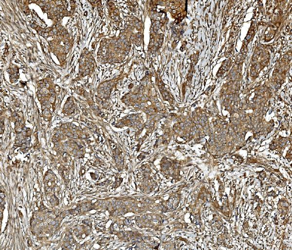 2 - Anti-PP2A-alpha/PPP2CA Antibody Picoband™ (monoclonal, 3B6) ABO14963
