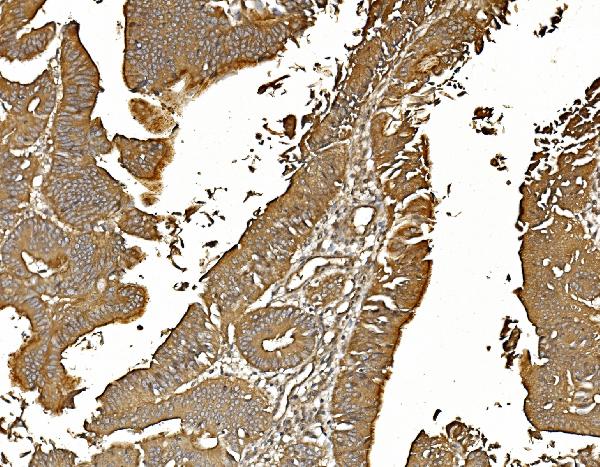 2 - Anti-PP2A-alpha/PPP2CA Antibody Picoband™ (monoclonal, 3B6) ABO14963