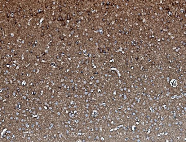 2 - Anti-PP2A-alpha/PPP2CA Antibody Picoband™ (monoclonal, 3B6) ABO14963