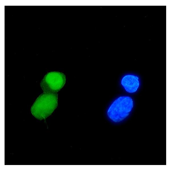 3 - Anti-TIF1 gamma/TRIM33 Antibody Picoband™ (monoclonal, 8I8) ABO14964