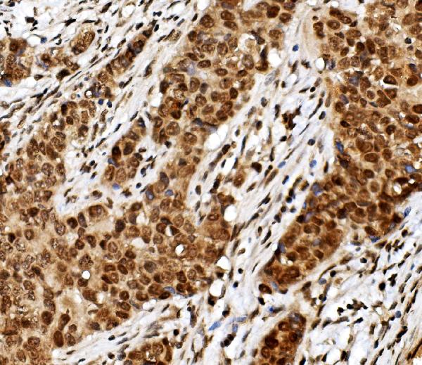 2 - Anti-TIF1 gamma/TRIM33 Antibody Picoband™ (monoclonal, 8I8) ABO14964