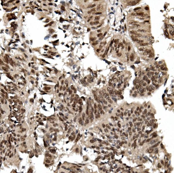 2 - Anti-TIF1 gamma/TRIM33 Antibody Picoband™ (monoclonal, 8I8) ABO14964
