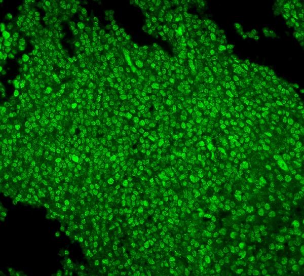 3 - Anti-MCM2 Antibody Picoband™ (monoclonal, 11C4) ABO14965