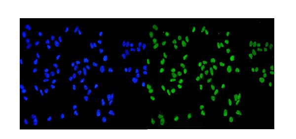 3 - Anti-MCM2 Antibody Picoband™ (monoclonal, 11C4) ABO14965