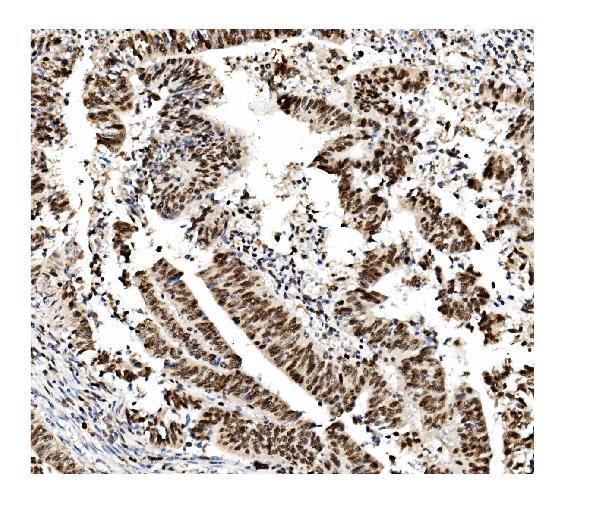 2 - Anti-MCM2 Antibody Picoband™ (monoclonal, 11C4) ABO14965