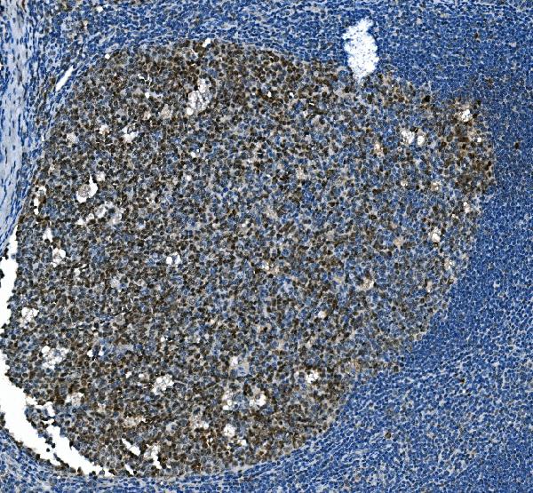 2 - Anti-MCM2 Antibody Picoband™ (monoclonal, 11C4) ABO14965