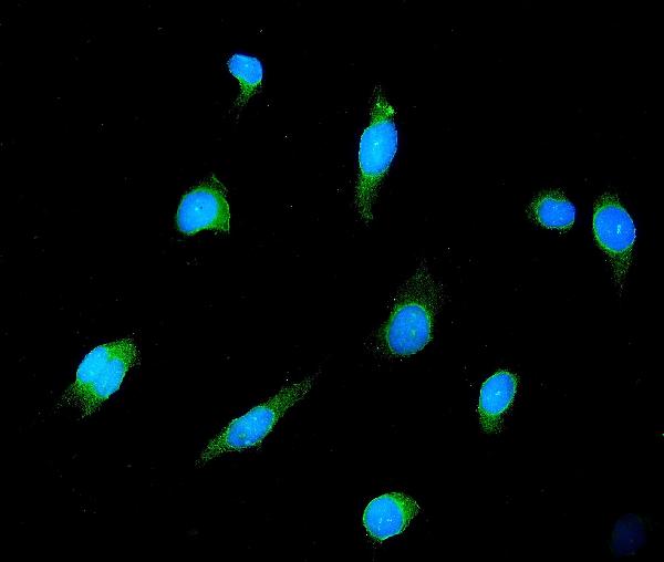 3 - Anti-GAD65/GAD2 Antibody Picoband™ (monoclonal, 7G2) ABO14966
