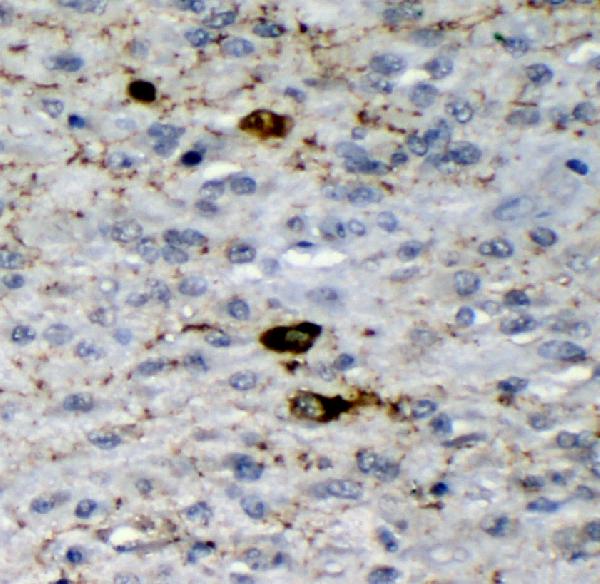 2 - Anti-GAD65/GAD2 Antibody Picoband™ (monoclonal, 7G2) ABO14966