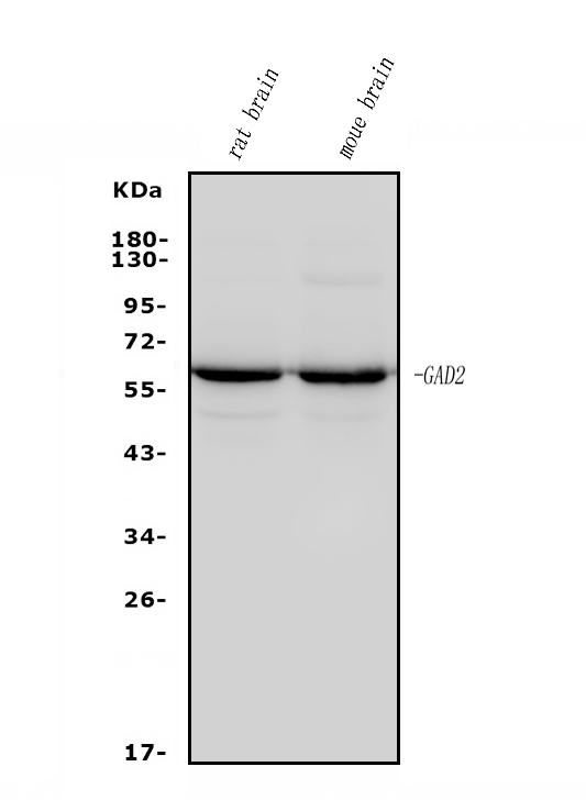 1 - Anti-GAD65/GAD2 Antibody Picoband™ (monoclonal, 4E12) ABO14967