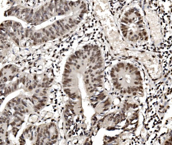 2 - Anti-hnRNP D/AUF1/HNRNPD Antibody Picoband™ (monoclonal, 2B12) ABO14968