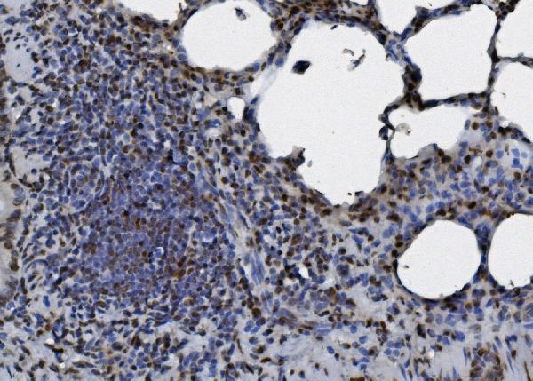 2 - Anti-hnRNP D/AUF1/HNRNPD Antibody Picoband™ (monoclonal, 2B12) ABO14968