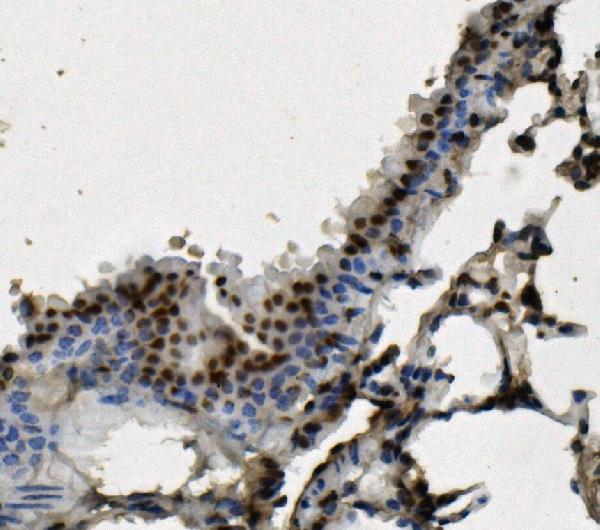 2 - Anti-hnRNP D/AUF1/HNRNPD Antibody Picoband™ (monoclonal, 2B12) ABO14968