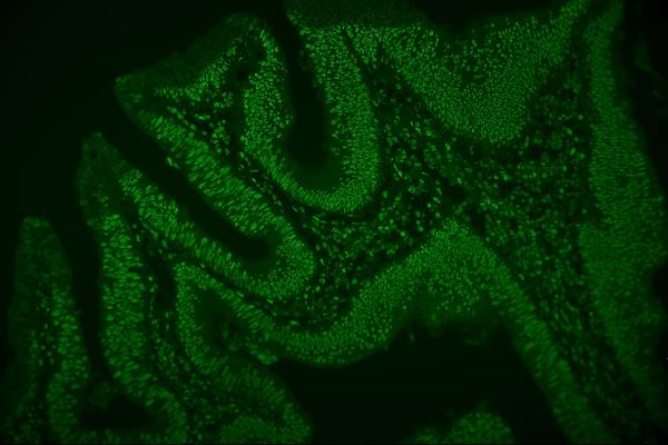 3 - Anti-hnRNP D/AUF1/HNRNPD Antibody Picoband™ (monoclonal, 4F3) ABO14969