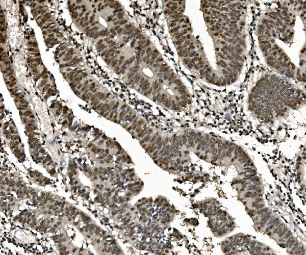 2 - Anti-hnRNP D/AUF1/HNRNPD Antibody Picoband™ (monoclonal, 4F3) ABO14969