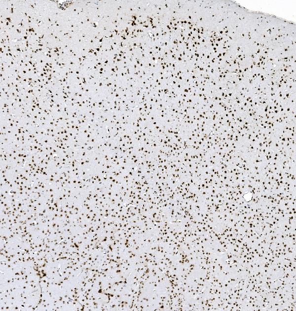 2 - Anti-hnRNP D/AUF1/HNRNPD Antibody Picoband™ (monoclonal, 4F3) ABO14969