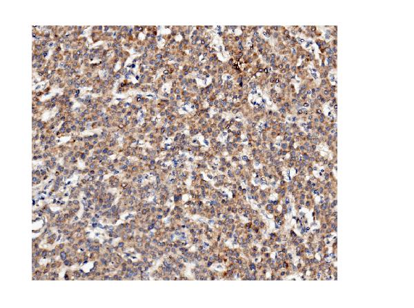 2 - Anti-ch TOG/CKAP5 Antibody Picoband™ (monoclonal, 3C13) ABO14974