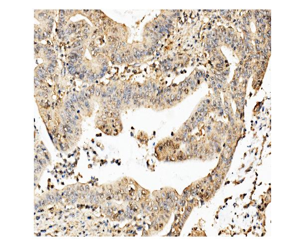 2 - Anti-ch TOG/CKAP5 Antibody Picoband™ (monoclonal, 3C13) ABO14974