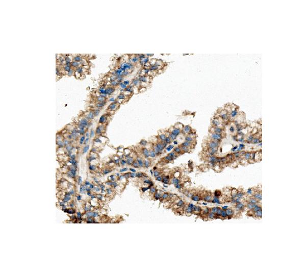 2 - Anti-ch TOG/CKAP5 Antibody Picoband™ (monoclonal, 3C13) ABO14974