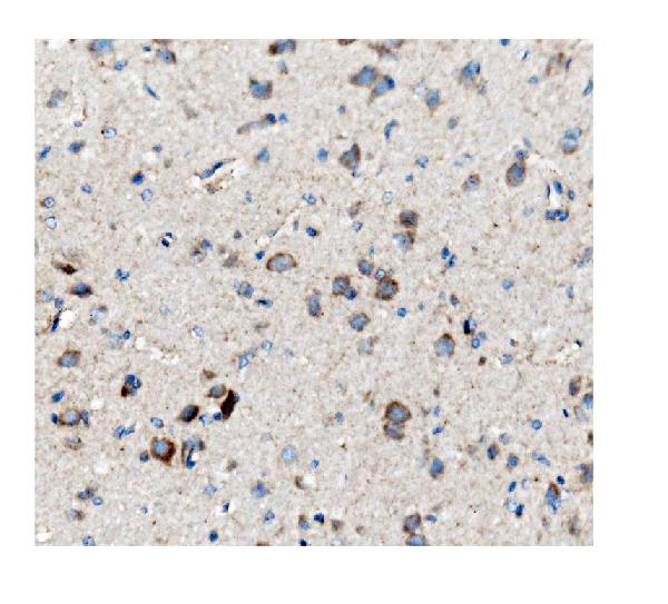 2 - Anti-ch TOG/CKAP5 Antibody Picoband™ (monoclonal, 3C13) ABO14974