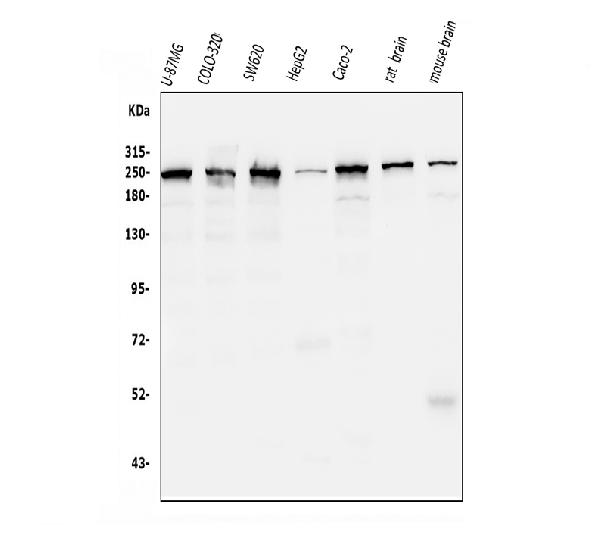 1 - Anti-ch TOG/CKAP5 Antibody Picoband™ (monoclonal, 3C13) ABO14974