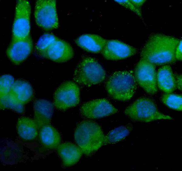 3 - Anti-IDH2 Antibody Picoband™ (monoclonal, 2D4) ABO14975