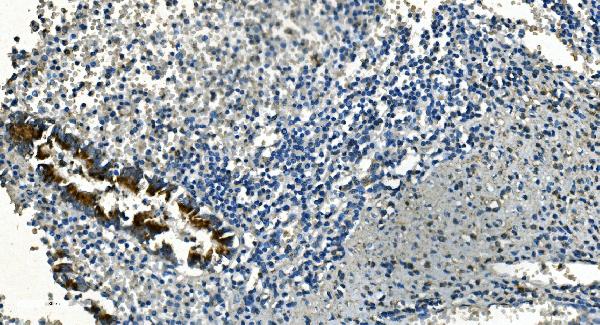 2 - Anti-IDH2 Antibody Picoband™ (monoclonal, 2H4) ABO14976