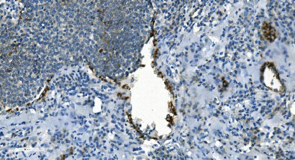 2 - Anti-IDH2 Antibody Picoband™ (monoclonal, 2H4) ABO14976