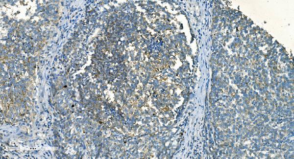 2 - Anti-IDH2 Antibody Picoband™ (monoclonal, 2H4) ABO14976