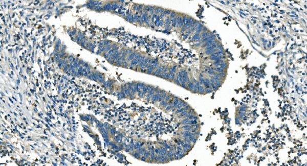 2 - Anti-IDH2 Antibody Picoband™ (monoclonal, 2H4) ABO14976