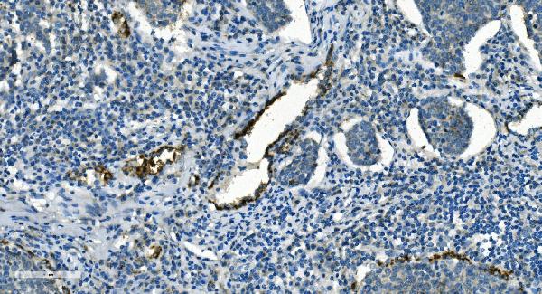 2 - Anti-IDH2 Antibody Picoband™ (monoclonal, 2H4) ABO14976