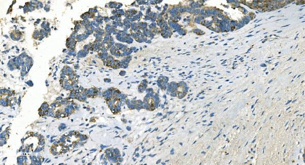 2 - Anti-IDH2 Antibody Picoband™ (monoclonal, 2H4) ABO14976
