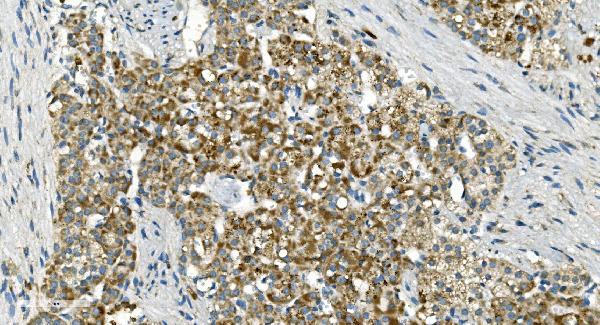 2 - Anti-IDH2 Antibody Picoband™ (monoclonal, 2H4) ABO14976