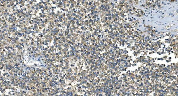2 - Anti-IDH2 Antibody Picoband™ (monoclonal, 2H4) ABO14976