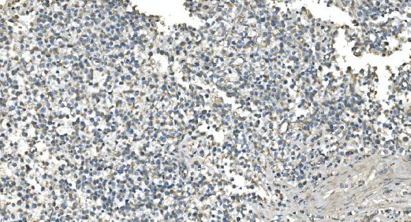 2 - Anti-IDH2 Antibody Picoband™ (monoclonal, 6B13) ABO14977
