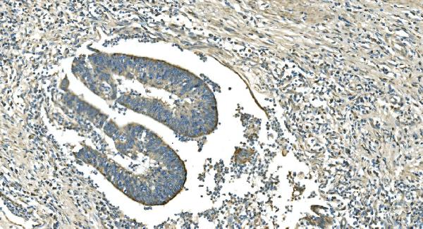 2 - Anti-IDH2 Antibody Picoband™ (monoclonal, 6B13) ABO14977