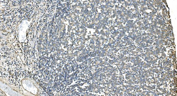 2 - Anti-IDH2 Antibody Picoband™ (monoclonal, 6B13) ABO14977