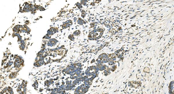 2 - Anti-IDH2 Antibody Picoband™ (monoclonal, 6B13) ABO14977