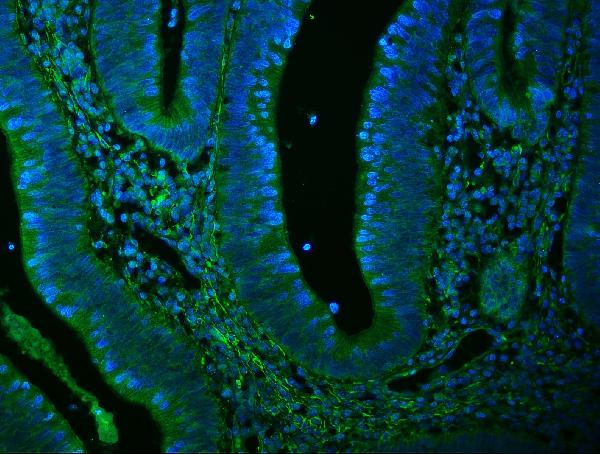 3 - Anti-Filamin A/FLNA Antibody Picoband™ (monoclonal, 3F8) ABO14978