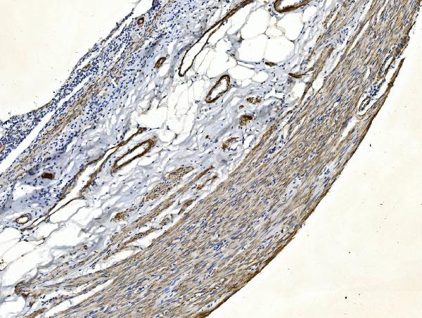 2 - Anti-Filamin A/FLNA Antibody Picoband™ (monoclonal, 3F8) ABO14978