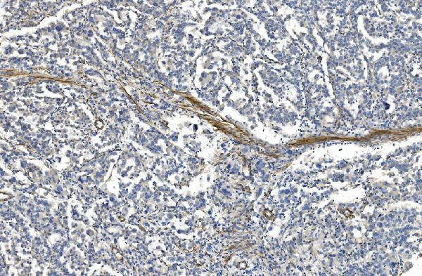 2 - Anti-Filamin A/FLNA Antibody Picoband™ (monoclonal, 3F8) ABO14978