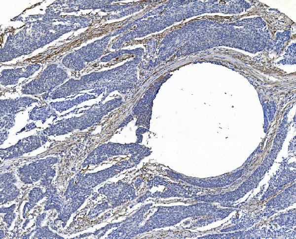 2 - Anti-Filamin A/FLNA Antibody Picoband™ (monoclonal, 3F8) ABO14978