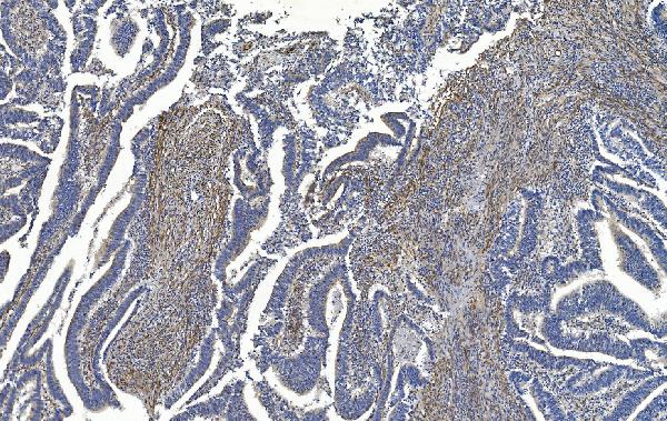 2 - Anti-Filamin A/FLNA Antibody Picoband™ (monoclonal, 3F8) ABO14978