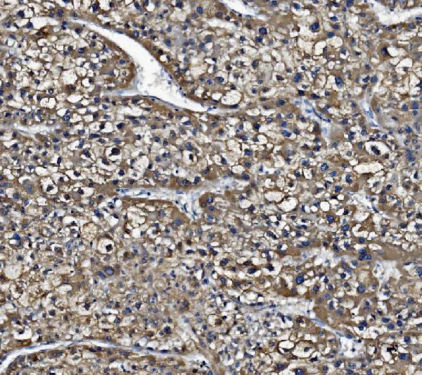2 - Anti-Liver Carboxylesterase 1/CES1 Antibody Picoband™ (monoclonal, 3F10) ABO14979