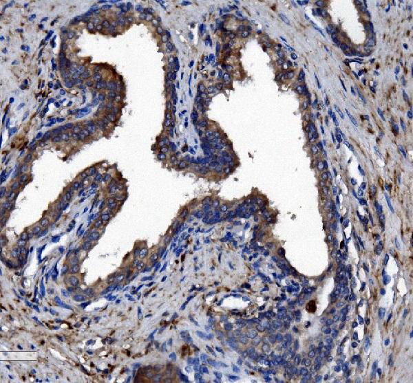 2 - Anti-Liver Carboxylesterase 1/CES1 Antibody Picoband™ (monoclonal, 3F10) ABO14979