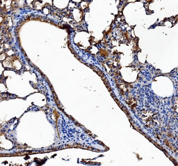 2 - Anti-Liver Carboxylesterase 1/CES1 Antibody Picoband™ (monoclonal, 3F10) ABO14979