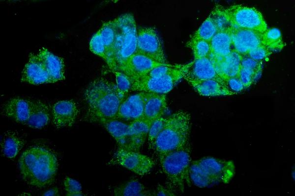 3 - Anti-PCK2 Antibody Picoband™ (monoclonal, 3F7) ABO14980
