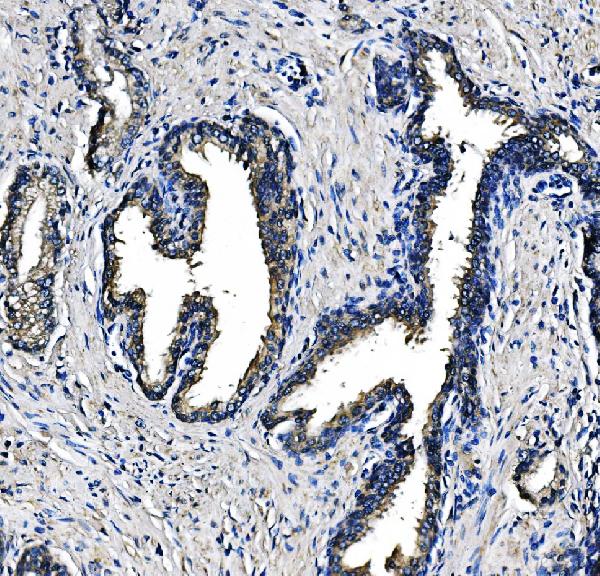 2 - Anti-PCK2 Antibody Picoband™ (monoclonal, 3F7) ABO14980