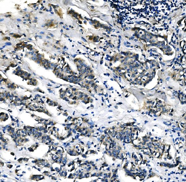 2 - Anti-PCK2 Antibody Picoband™ (monoclonal, 3F7) ABO14980