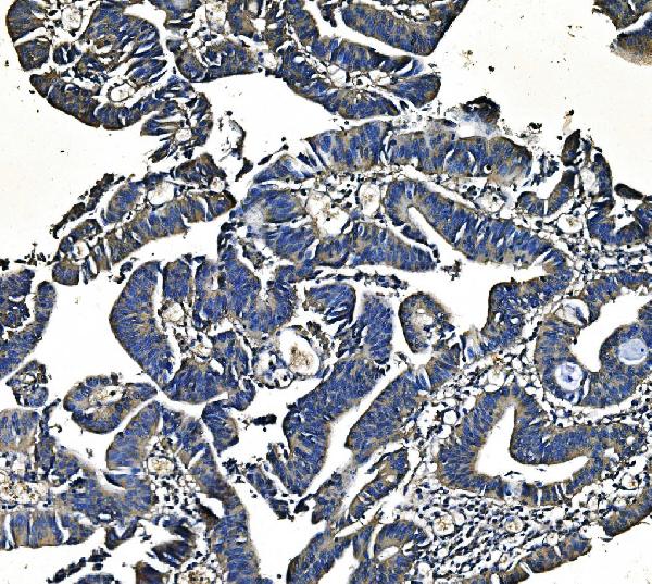 2 - Anti-PCK2 Antibody Picoband™ (monoclonal, 3F7) ABO14980