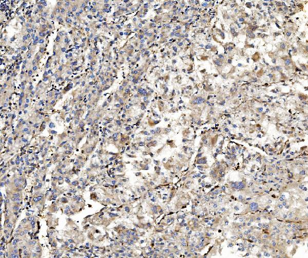 2 - Anti-Aldolase/ALDOA Antibody Picoband™ (monoclonal, 6H8) ABO14982